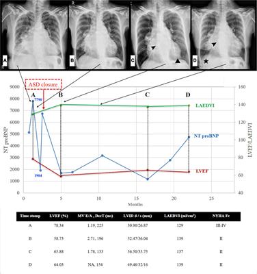 Case report: The impact of percutaneous atrial septal defect closure in pulmonary hypertension with co-existing <mark class="highlighted">cor</mark> triatriatum sinister and multiple cardiac comorbidities